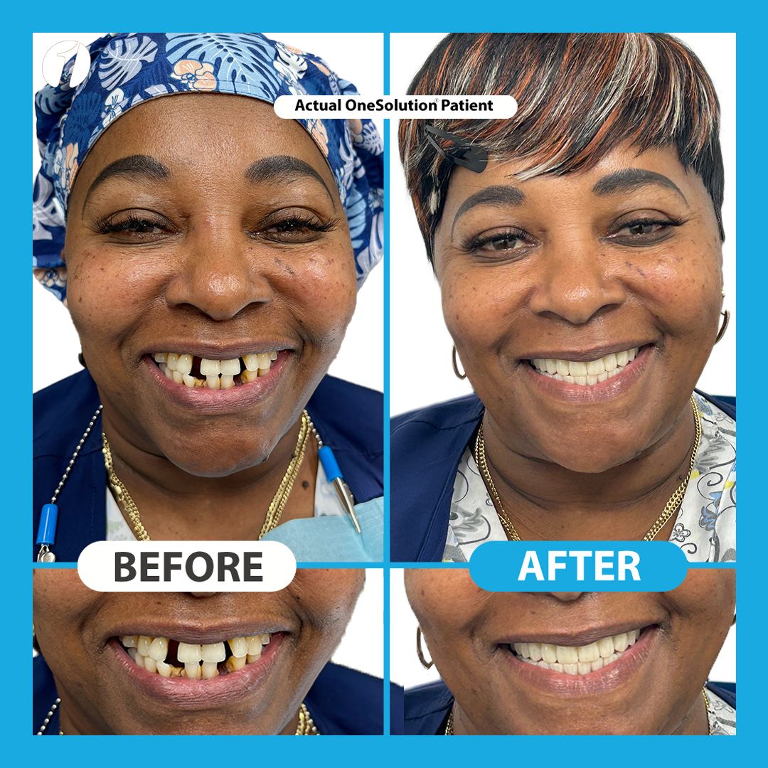 Before & After Transformations